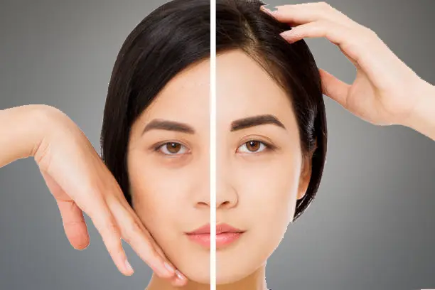 Eye Creams for Dark Circles, dermatologist recommended eye creams