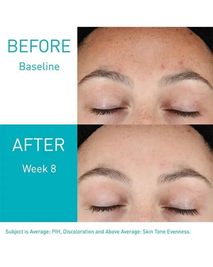 Skin Renewing Vitamin C Serum